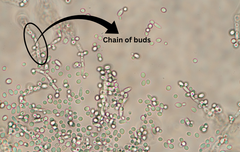 Yeast reproducing under microscope.