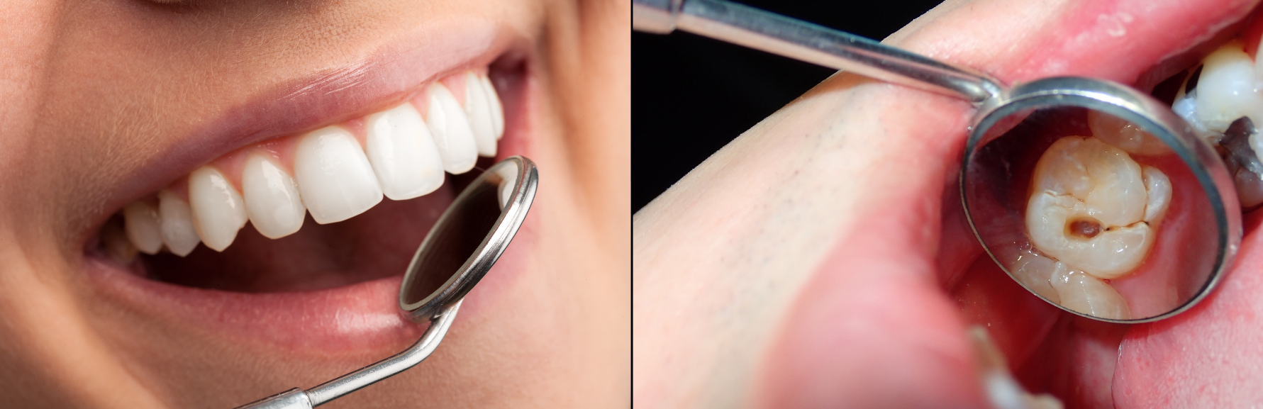 Dentist examining teeth using mirrors.