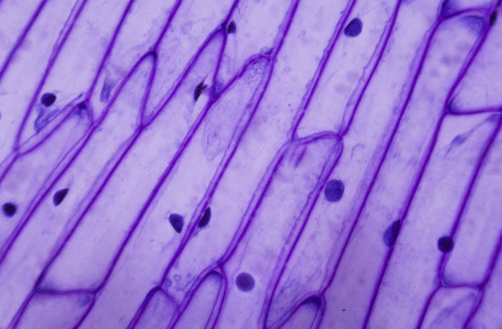 Cells of onion peel under microscope.